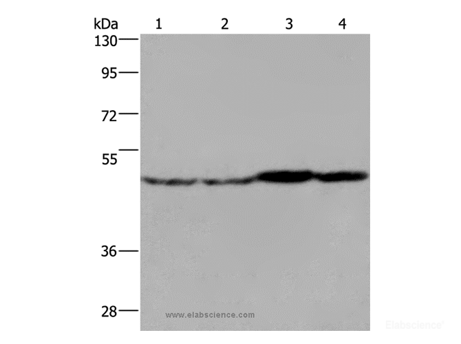 Western Blot analysis of Mouse liver, brain and heart tissue, RAW264.7 cell using FH Polyclonal Antibody at dilution of 1:850