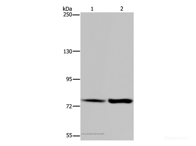 Western Blot analysis of Hela and K562 cell using GAB2 Polyclonal Antibody at dilution of 1:300