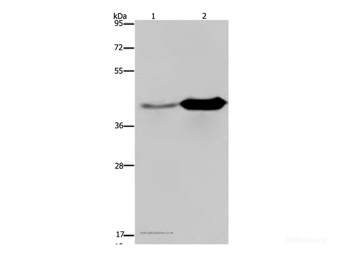 Western Blot analysis of Mouse liver and brain tissue using GLUL Polyclonal Antibody at dilution of 1:650