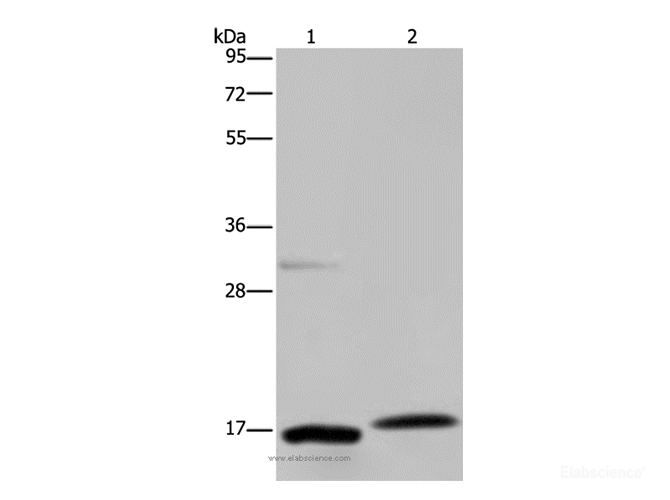Western Blot analysis of Mouse adrenal gland and liver tissue using PAEP Polyclonal Antibody at dilution of 1:250