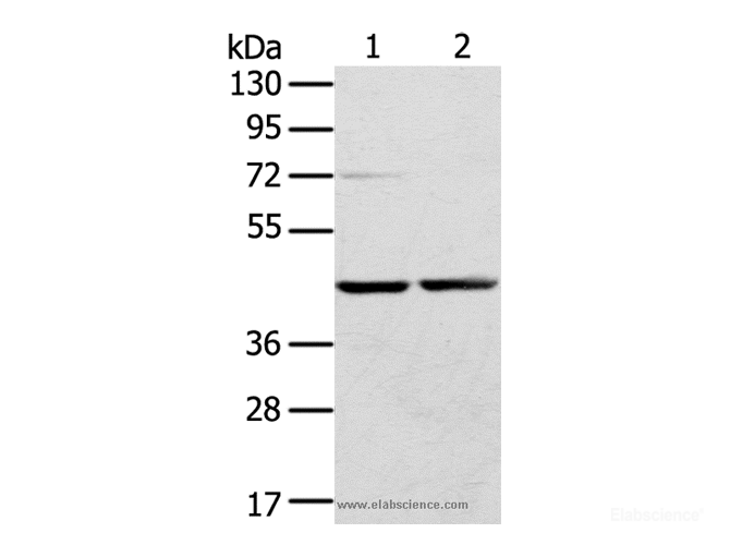 Western Blot analysis of Hepg2 and hela cell using RRAGA Polyclonal Antibody at dilution of 1:400