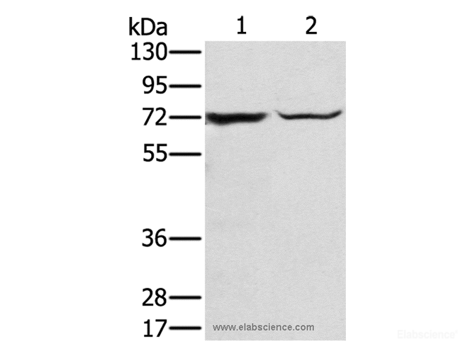 Western Blot analysis of Mouse liver tissue and hepg2 cell using SLC25A13 Polyclonal Antibody at dilution of 1:450