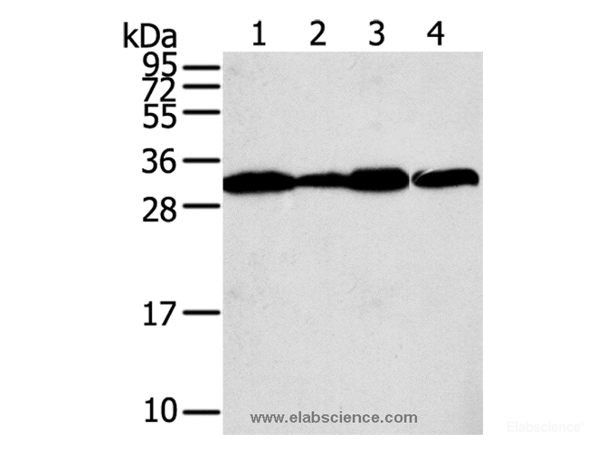 Western Blot analysis of A375, A431, lovo and hela cell using STX10 Polyclonal Antibody at dilution of 1:800