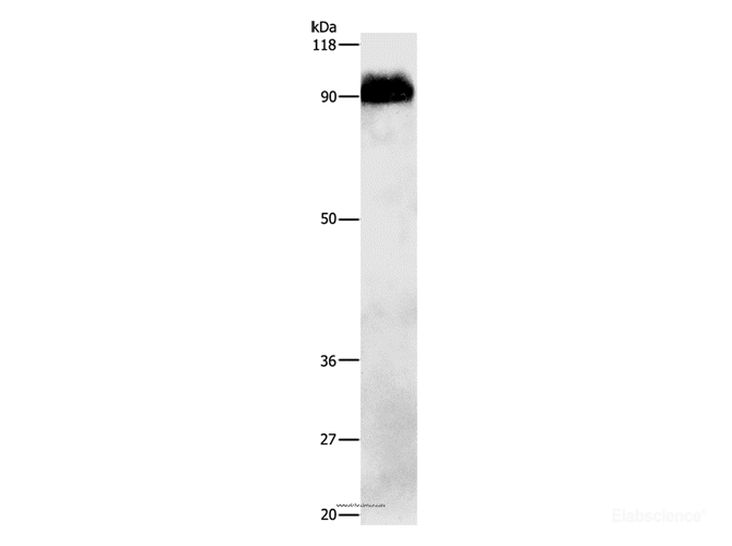 Western Blot analysis of Mouse brain tissue using beta Amyloid Polyclonal Antibody at dilution of 1:1000