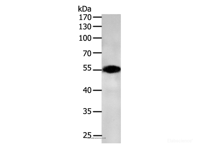 Western Blot analysis of NIH/3T3 cell using CASP12 Polyclonal Antibody at dilution of 1:700