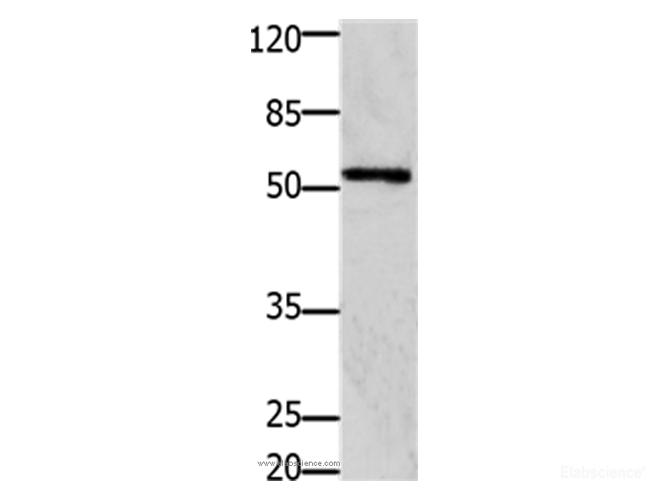 Western Blot analysis of 293T cell using GFRA1 Polyclonal Antibody at dilution of 1:1250