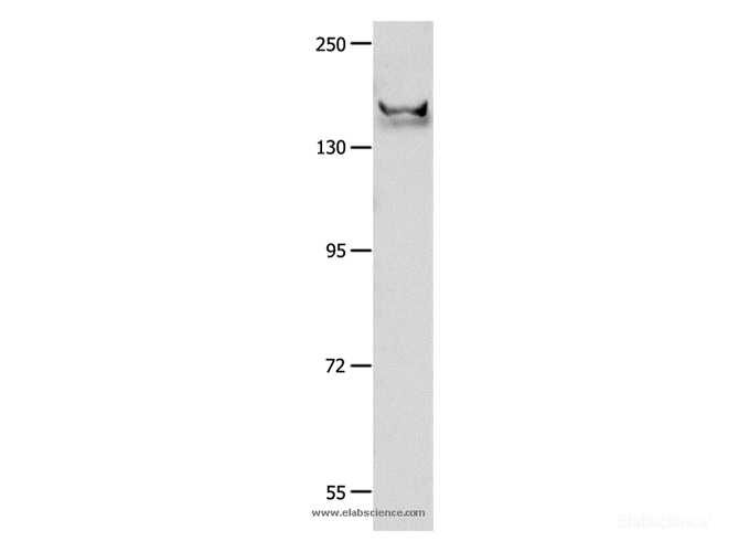 Western Blot analysis of Mouse brain tissue using GRIN2B Polyclonal Antibody at dilution of 1:700