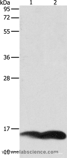 Western Blot analysis of A549 and Jurkat cell using PFN1 Polyclonal Antibody at dilution of 1:1000