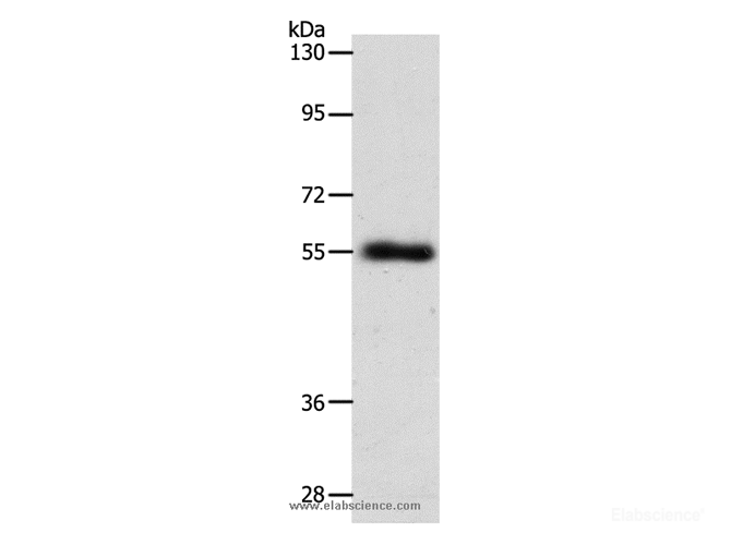 Western Blot analysis of Mouse lung tissue using SLC1A5 Polyclonal Antibody at dilution of 1:600
