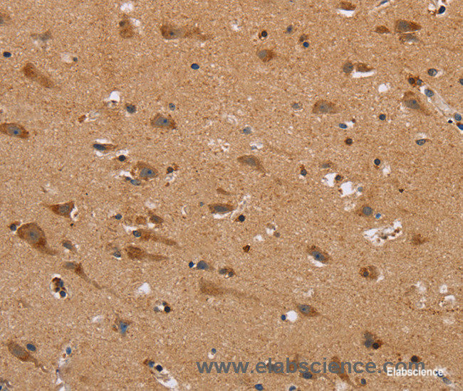 Immunohistochemistry of paraffin-embedded Human brain tissue using NDRG3 Polyclonal Antibody at dilution 1:40