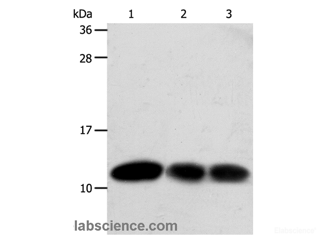 Western Blot analysis of Hela and MCF7 cell, Human liver cancer tissue using TXN Polyclonal Antibody at dilution of 1:600