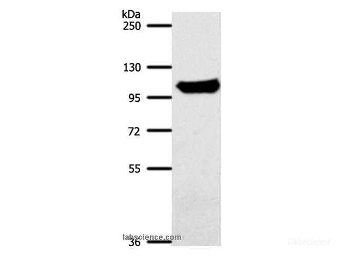Western Blot analysis of Mouse liver tissue using ACO1 Polyclonal Antibody at dilution of 1:700