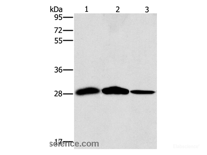 Western Blot analysis of Mouse liver and Human chromaffin cell tumor tissue, hepG2 cell using SPR Polyclonal Antibody at dilution of 1:1500