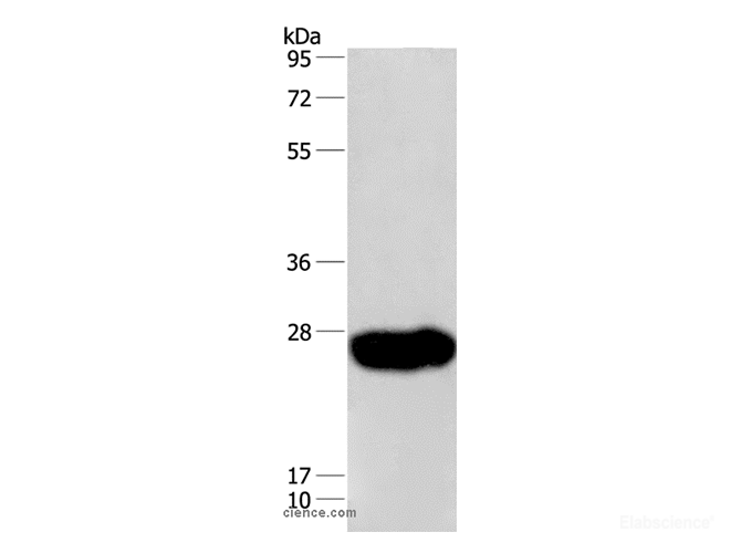 Western Blot analysis of Human fetal muscle tissue using CAV3 Polyclonal Antibody at dilution of 1:550