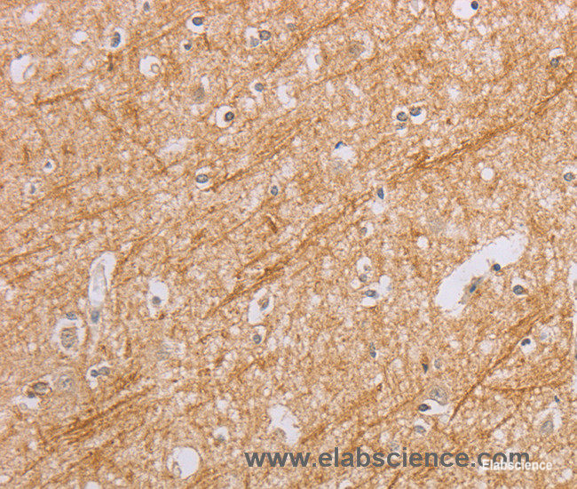 Immunohistochemistry of paraffin-embedded Human brain tissue using BGLAP Polyclonal Antibody at dilution of 1:40