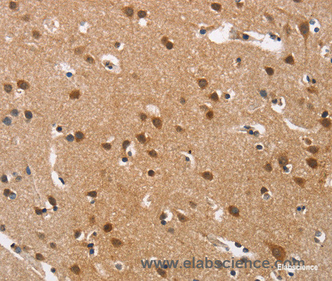 Immunohistochemistry of paraffin-embedded Human brain tissue using Cav1.3 Polyclonal Antibody at dilution 1:40