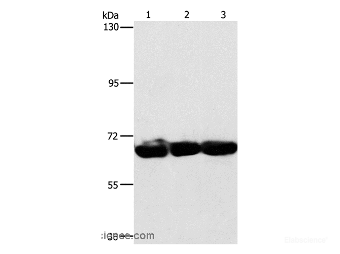 Western Blot analysis of 293T, hepG2 and A549 cell using CKAP4 Polyclonal Antibody at dilution of 1:750