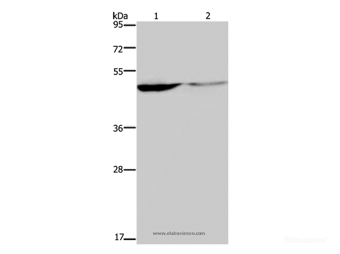 Western Blot analysis of Human paraneoplastic and normal kidney tissue using KCNK9 Polyclonal Antibody at dilution of 1:650