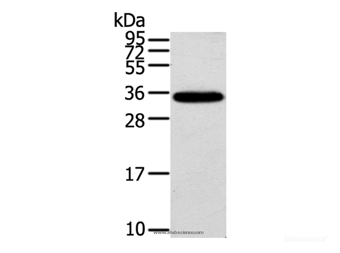Western Blot analysis of Mouse brain tissue using KCNMB3 Polyclonal Antibody at dilution of 1:300