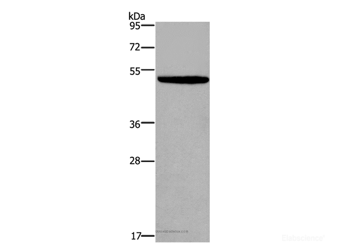 Western Blot analysis of NIH/3T3 cell using KCNN4 Polyclonal Antibody at dilution of 1:450