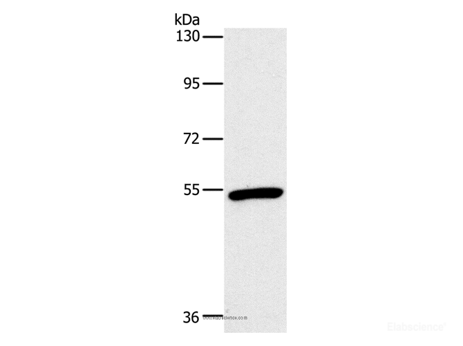 Western Blot analysis of Mouse heart tissue using OXTR Polyclonal Antibody at dilution of 1:866