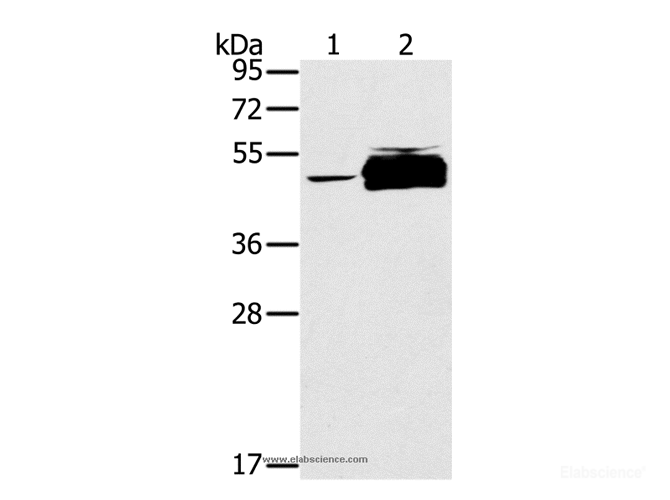 Western Blot analysis of K562 cell and Human testis tissue using PTPN20 Polyclonal Antibody at dilution of 1:200