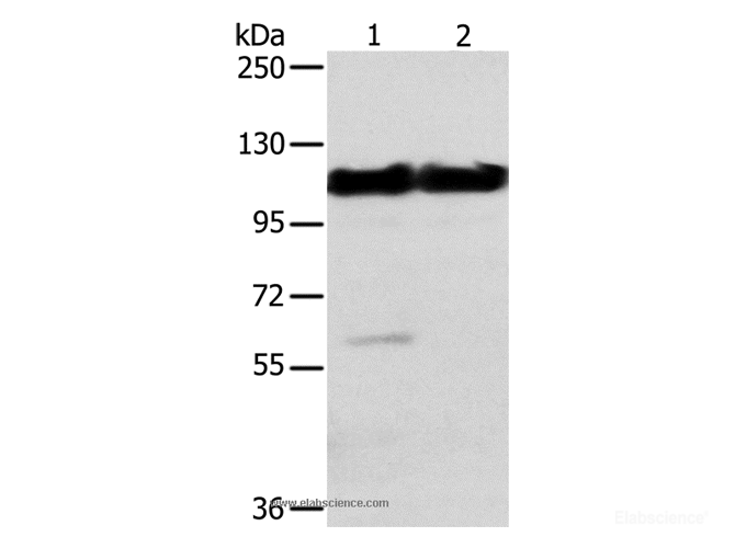 Western Blot analysis of Mouse heart and muscle tissue using ACTN2 Polyclonal Antibody at dilution of 1:200