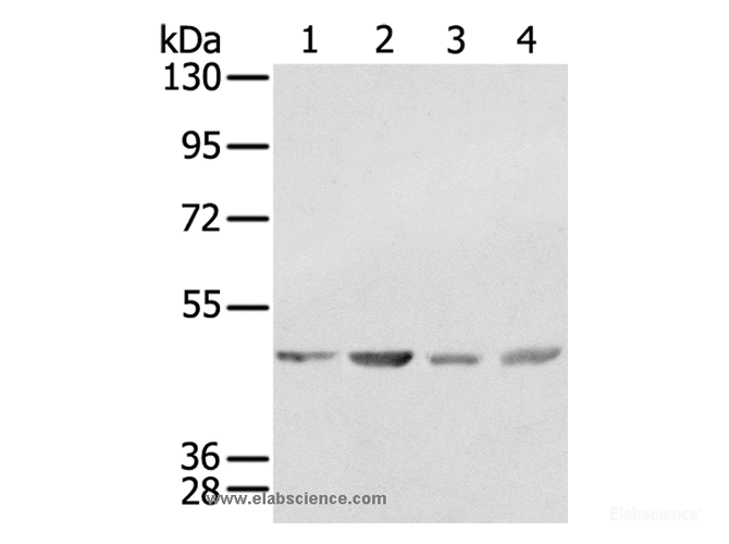 Western Blot analysis of K562, 231, Raji and hela cell using SSB Polyclonal Antibody at dilution of 1:400