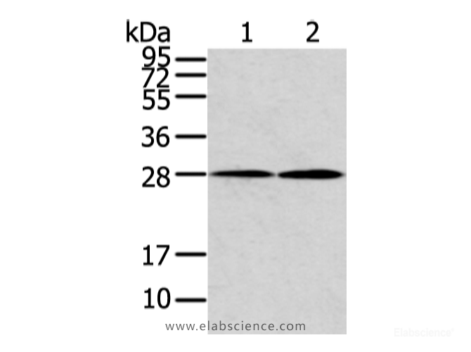 Western Blot analysis of Mouse heart and lung tissue using KCNMB1 Polyclonal Antibody at dilution of 1/500