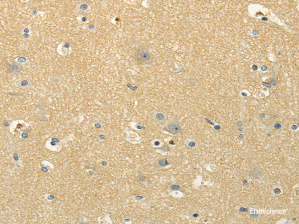 Immunohistochemistry of paraffin-embedded Human brain using MSI1 Polyclonal Antibody at dilution of 1/30