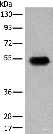 Western blot analysis of Human fetal brain tissue lysate using CDT1 Polyclonal Antibody at dilution of 1:400