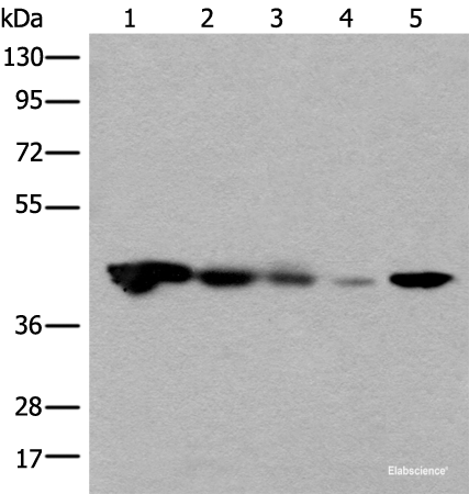Western blot analysis of Jurkat HEPG2 and Hela cell Human testis tissue 231 cell lysates using CECR5 Polyclonal Antibody at dilution of 1:650