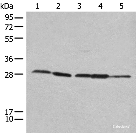 Western blot analysis of 293T Hela 231 HEPG2 and A431 cell lysates using RPL14 Polyclonal Antibody at dilution of 1:800
