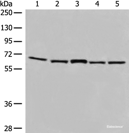 Western blot analysis of TM4 and 231 cell Mouse brain tissue Hela and HT-29 cell lysates using EHD1 Polyclonal Antibody at dilution of 1:500