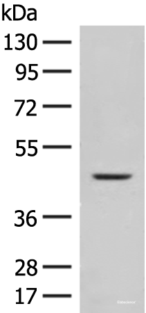 Western blot analysis of Mouse liver tissue lysate using FUT10 Polyclonal Antibody at dilution of 1:450