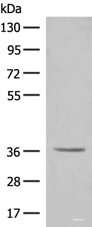 Western blot analysis of HT-29 cell lysate using LGALS4 Polyclonal Antibody at dilution of 1:300