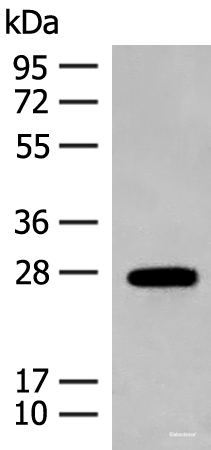 Western blot analysis of Mouse eye tissue lysate using GUCA1B Polyclonal Antibody at dilution of 1:500
