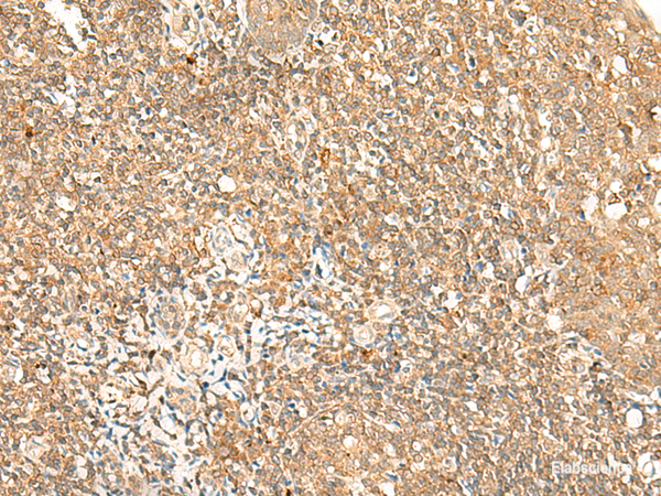 Immunohistochemistry of paraffin-embedded Human tonsil tissue using GPR89A/GPR89B Polyclonal Antibody at dilution of 1:25(×200)
