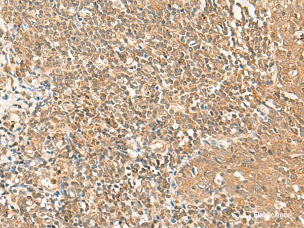 Immunohistochemistry of paraffin-embedded Human tonsil tissue using GRIPAP1 Polyclonal Antibody at dilution of 1:50(×200)