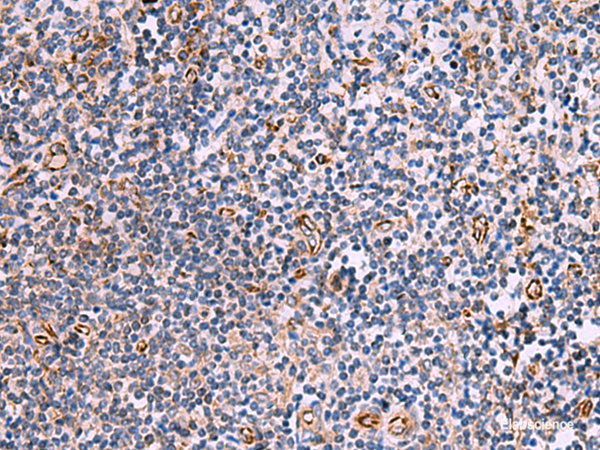 Immunohistochemistry of paraffin-embedded Human tonsil tissue using ITGA11 Polyclonal Antibody at dilution of 1:75(×200)