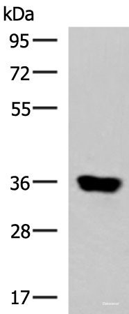 Western blot analysis of Human muscle tissue lysate using KCNK15 Polyclonal Antibody at dilution of 1:1000