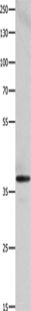Western blot analysis of HepG2 cells using HMOX2 Polyclonal Antibody at dilution of 1:500