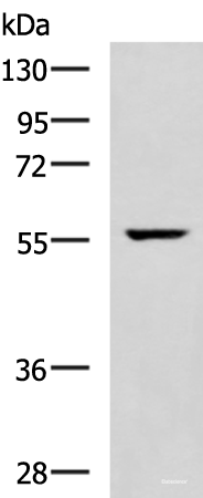 Western blot analysis of Mouse heart tissue lysate using TRAF6 Polyclonal Antibody at dilution of 1:300