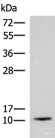 Western blot analysis of Human fetal brain tissue lysate using ACYP1 Polyclonal Antibody at dilution of 1:700