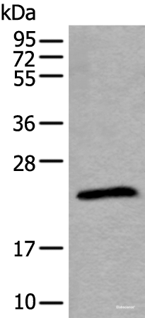 Western blot analysis of Jurkat cell lysate using TPT1 Polyclonal Antibody at dilution of 1:800