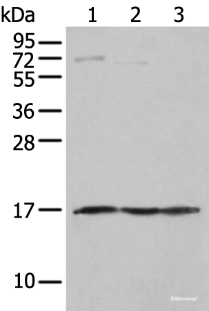 Western blot analysis of Human fetal muscle tissue PC-3 and Jurkat cell using NDUFA12 Polyclonal Antibody at dilution of 1:300