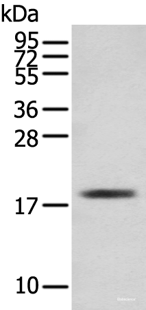 Western blot analysis of Mouse skeletal muscle tissue using TNNC1 Polyclonal Antibody at dilution of 1:250