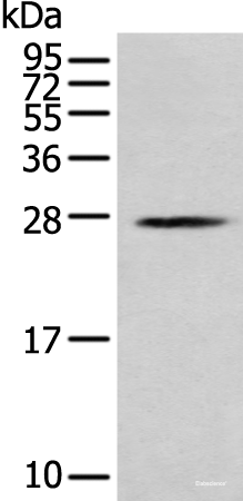Western blot analysis of K562 cell using MOB1B Polyclonal Antibody at dilution of 1:250