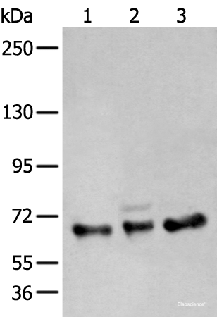 Western blot analysis of A431 K562 and TM4 cell lysates using ZBTB5 Polyclonal Antibody at dilution of 1:400
