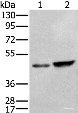 Western blot analysis of HUVEC and Hela cell lysates using ZNF24 Polyclonal Antibody at dilution of 1:350